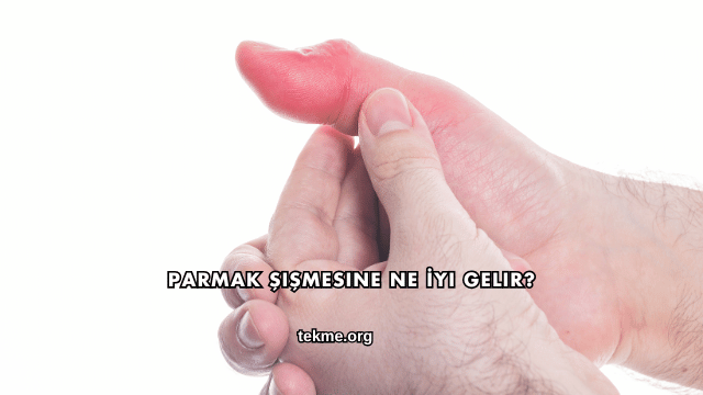 Parmak Şişmesine Ne İyi Gelir?