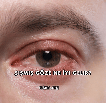 Şişmiş Göze Ne İyi Gelir?