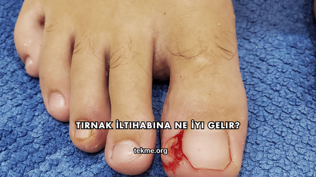 Tırnak İltihabına Ne İyi Gelir?