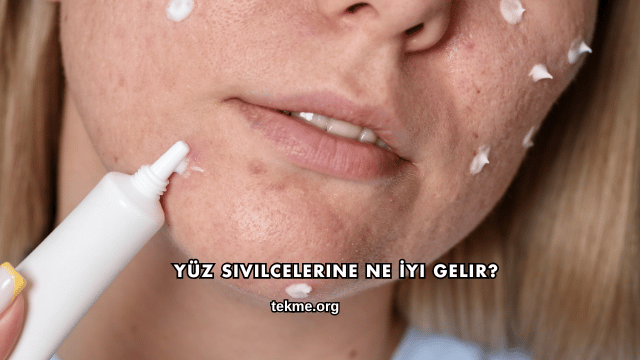 Yüz Sivilcelerine Ne İyi Gelir?