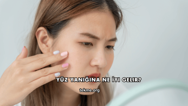 Yüz Yanığına Ne İyi Gelir?
