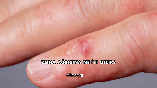 Zona Ağrısına Ne İyi Gelir?