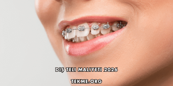 Diş Teli Maliyeti 2026